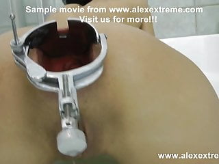 Alexextreme Speculum Prolapse Extreme Dildo...