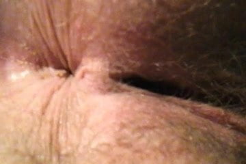 Hairy Asshole And Meaty Pussy 1