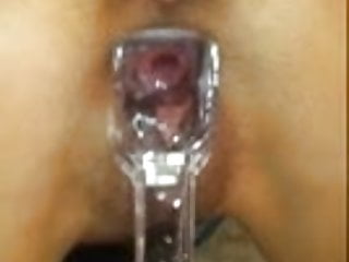 Amateur, Gaped, Too, Speculum